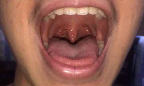 Parts of Your Mouth: What Do They Do?